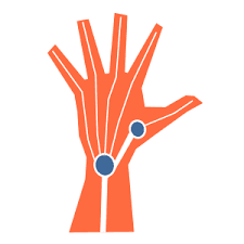 BionicoHand